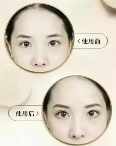 不用整容使鼻子变高挺,鼻子变高整容