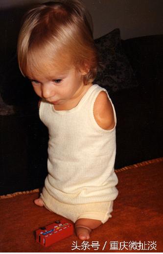 他没手没脚，却可以玩骑马、打鼓、游泳、足球，有两个大学学位。