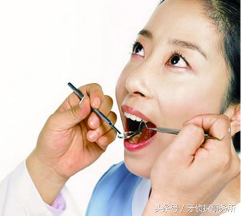 吃肉老塞牙有什么好的办法解决,吃肉老塞牙什么原因