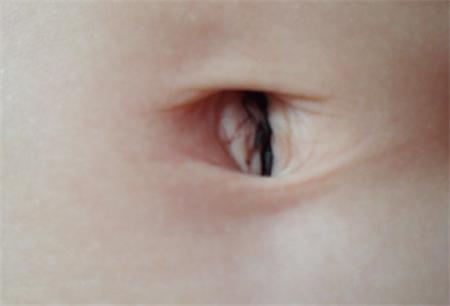 孕妇肚脐黑色污垢怎么清理,新生儿肚脐每天都要清理吗