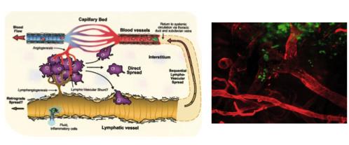 vegf是治疗肿瘤的药吗,肿瘤患者vegf检测参考值