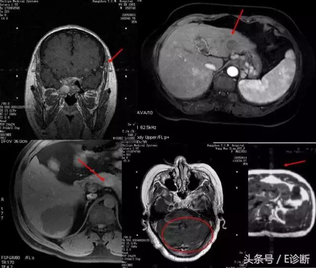 磁共振伪影及解决方案,e系列诊断