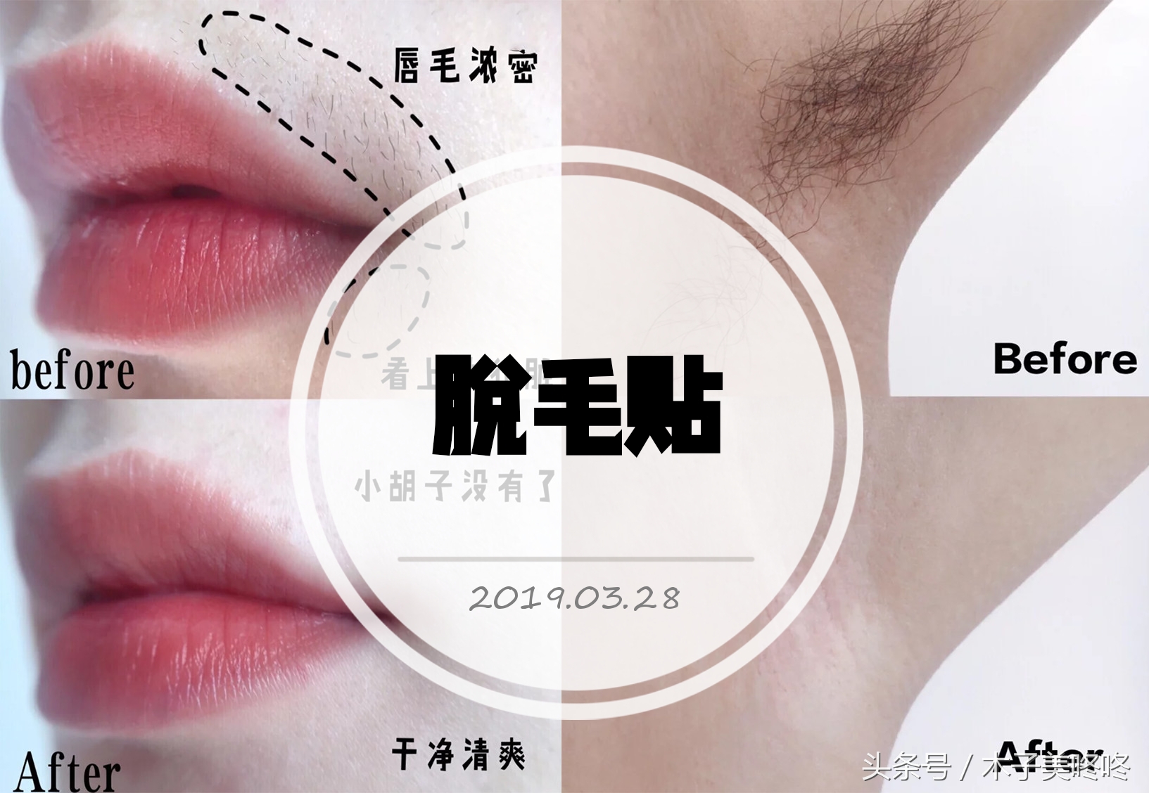 一次性脱毛和永久性脱毛的区别,冰点脱毛真的能永久性脱毛吗