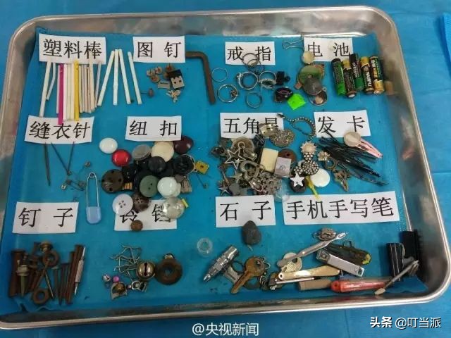 10岁孩子吞了个小钉子能排出吗,2岁宝宝误吞4厘米钉子