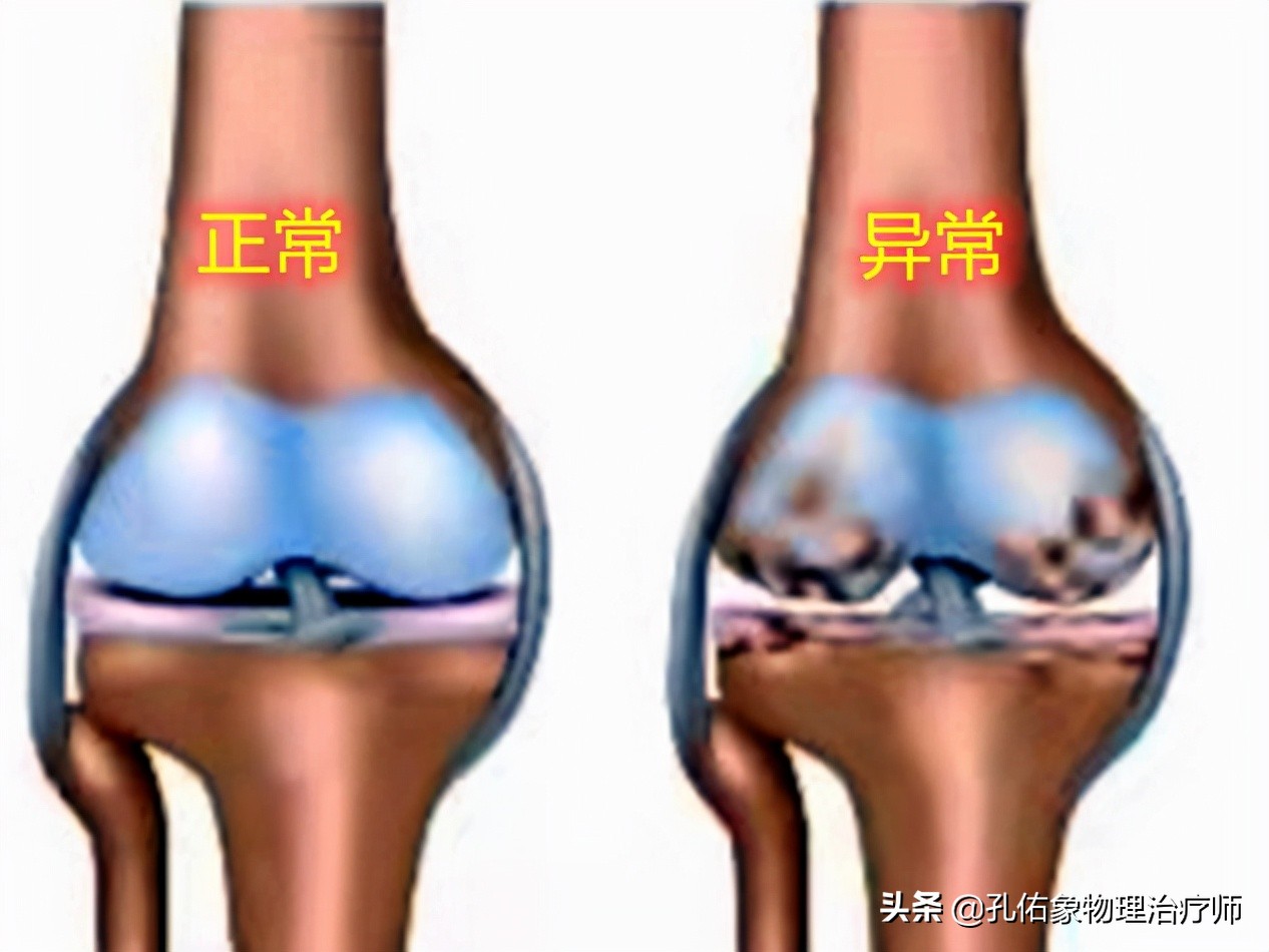 老年人腿脚无力要怎么避免,专治老年人下肢无力的方法