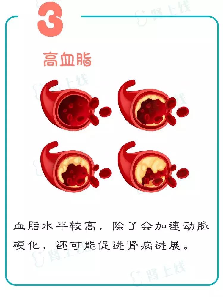 慢性肾病三期还能不能治愈,慢性肾病一定会发展尿毒症吗