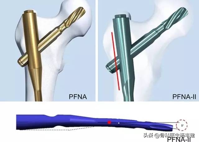老年人骨折的注意事项九大条,您知道吗?