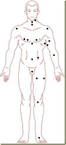 一眼就能看出你哪个部位有痣,痣相看看你哪颗痣是好的