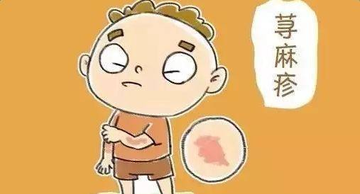 荨麻疹是由麻疹病毒引起的吗,麻疹是伤寒吗