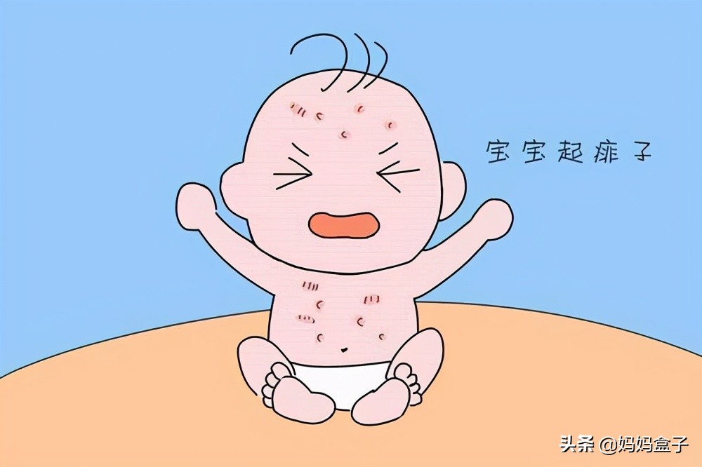 夏天宝宝出热痱子怎么护理,夏季如何处理宝宝热痱子