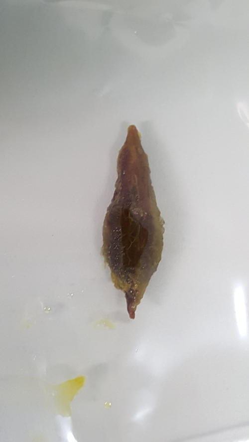 宝宝吞红枣核可以吃白萝卜吗,误吞枣核要吃多少韭菜