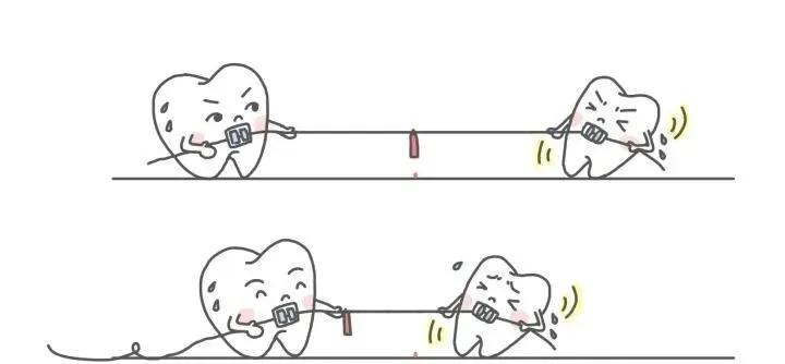 支抗钉和骨钉的区别,13岁矫正牙齿打骨钉亲身经历