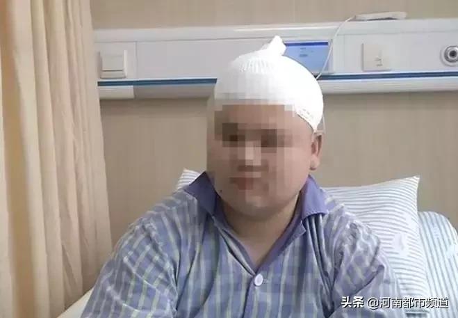 小伙反复头晕查出脑瘤,男子持续头痛竟是脑内有炸弹