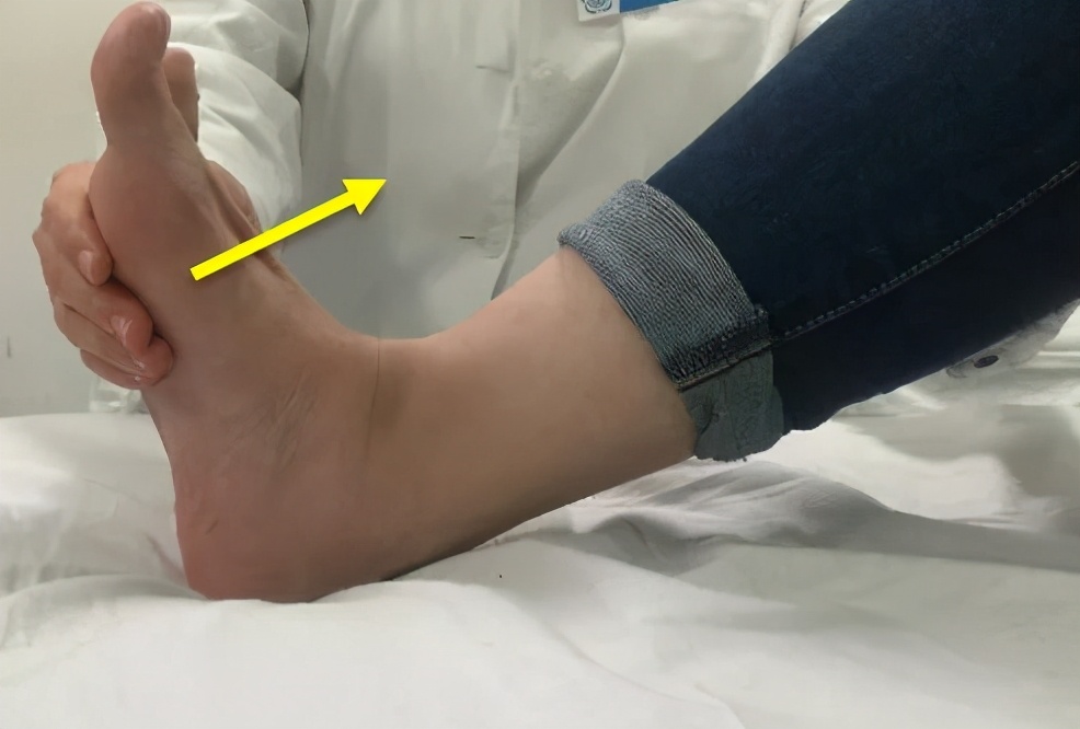 崴脚恢复不好的后遗症怎么治愈,崴脚一般几天就能恢复正常走路