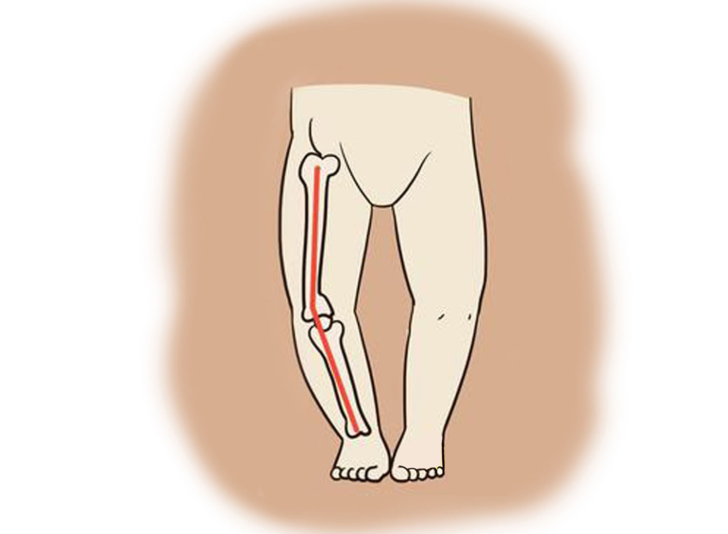 宝宝出现这几个信号，说明身体部位发育有问题，最佳治疗期别错过