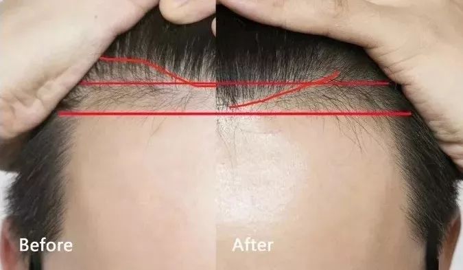 双十一要到了现在买会便宜吗,双十一适合买的手机