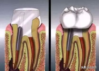 看牙贵早已成为无数人心中的痛点,为什么你会觉得看牙贵