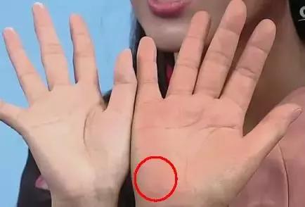 14种常见病的诊断方法,手诊10种常见病从手上就能看出来