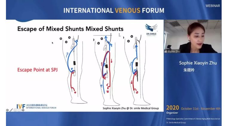 开幕第一天精彩回顾｜2020国际静脉病论坛持续进行中