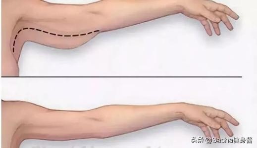 手臂拜拜肉怎么减最快瘦下来,手臂粗告别拜拜肉有什么方法