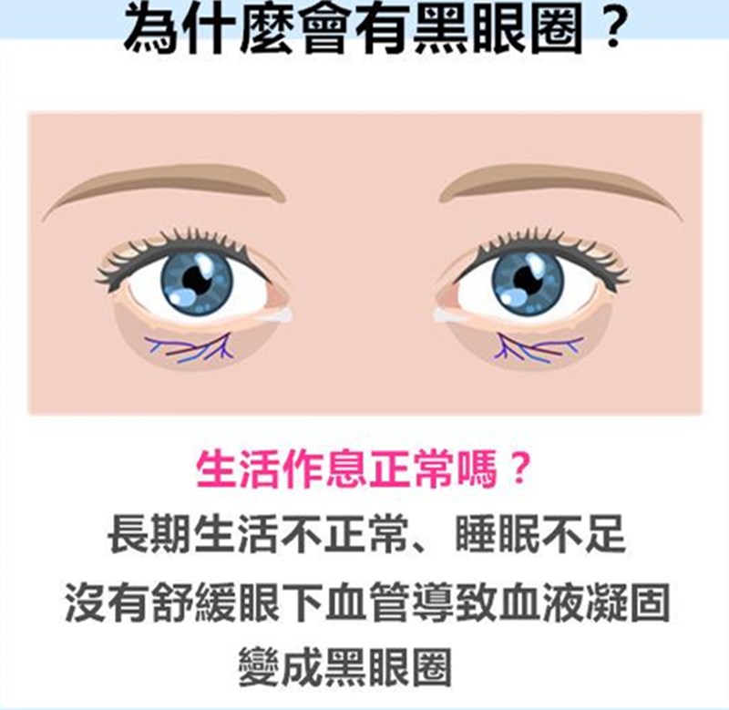 用眼霜快速去除黑眼圈的方法,哪些眼霜可以有效缓解黑眼圈