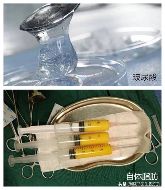 法令纹凸显怎么办,胖起来泪沟和法令纹会减轻吗