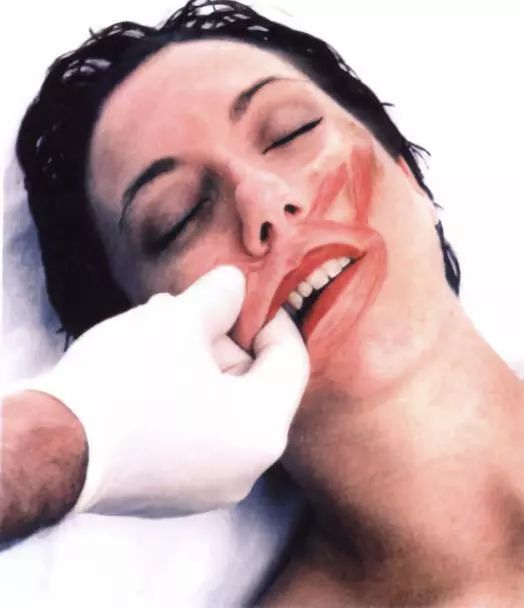 每日一肌大臂疼,牙疼咬肌肿了