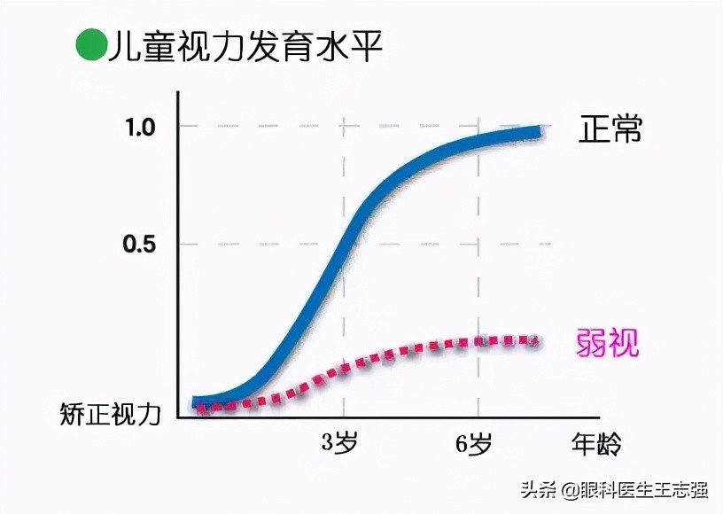 矫正视力手术多少钱,矫正视力是什么意思