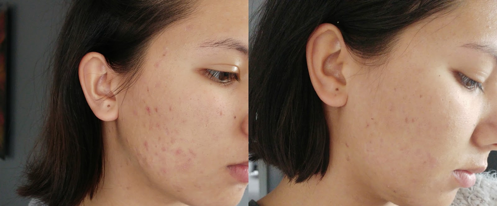 蔻诗美玫瑰果油敏感肌,蔻诗美玫瑰果油和赋活亮肤精华