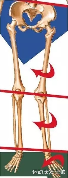 x腿纠正训练,x腿该怎么做才能变成直腿