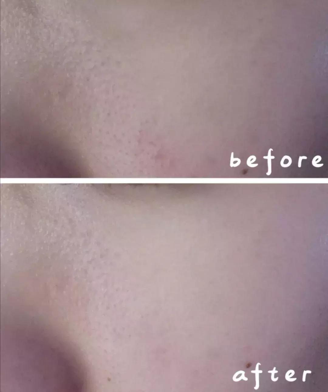 这些护肤成分不要混着用,护肤成分没选对会烂脸