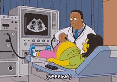 四维彩超和系统性超声的区别,四维彩超比普通b超准确吗