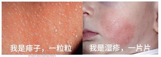 宝宝皮肤反复红块不凸起来,宝宝皮肤老是出问题是缺什么吗