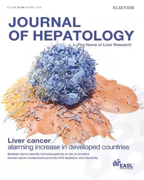 为什么说丙肝很容易引起肝癌,乙肝和丙肝哪个容易得肝癌