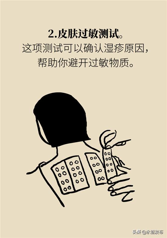 湿疹膏有哪些治疗效果好的,湿疹外用中药包怎么用