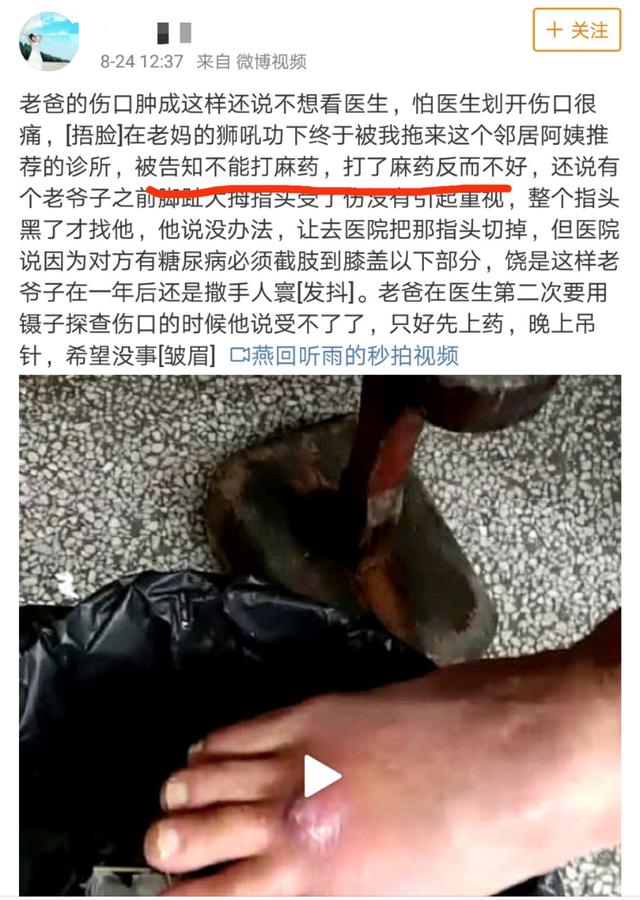 打麻药真没有后遗症吗,打麻药真的会胡说吗