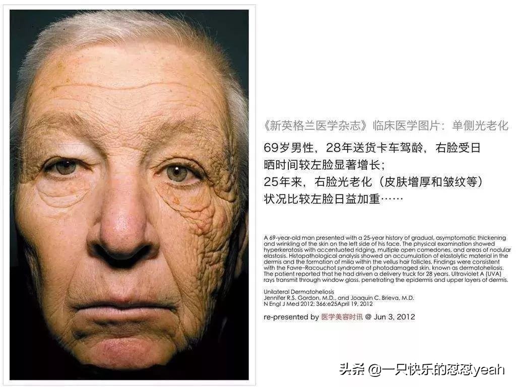 安耐晒的正确使用方法,安耐晒正确的使用方法