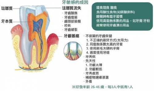 牙本质过敏的临床表现预防和治疗,牙本质过敏症治疗方法是