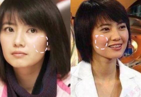 美容面部紧致提拉全过程,怎么做面部提拉改变大小脸