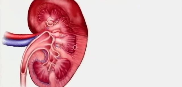 肾脏轻度萎缩的尿毒症治愈的案例,尿毒症脑病一般多长时间能治愈