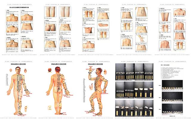 药王孙思邈养生秘诀常灸足三里,医圣孙思邈幼年病多常灸足三里