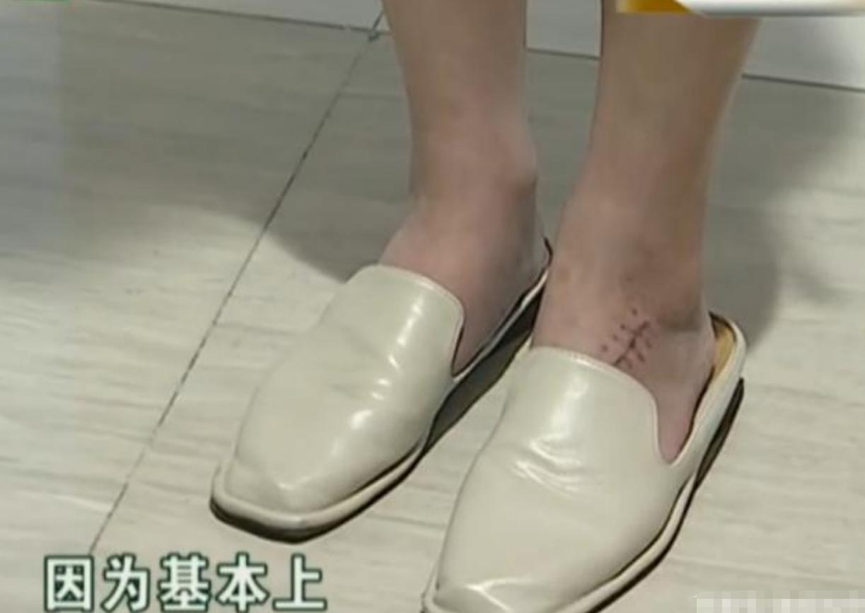 逛商场滑倒女子索赔三万,逛商场脚被砸伤骨折怎么赔偿