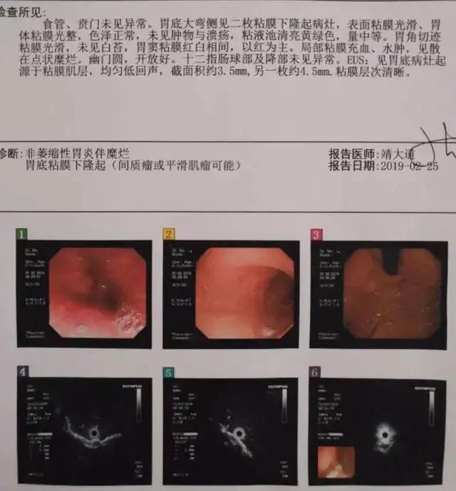 病人经常呕吐是什么原因,频繁嗳气一年了是大病吗