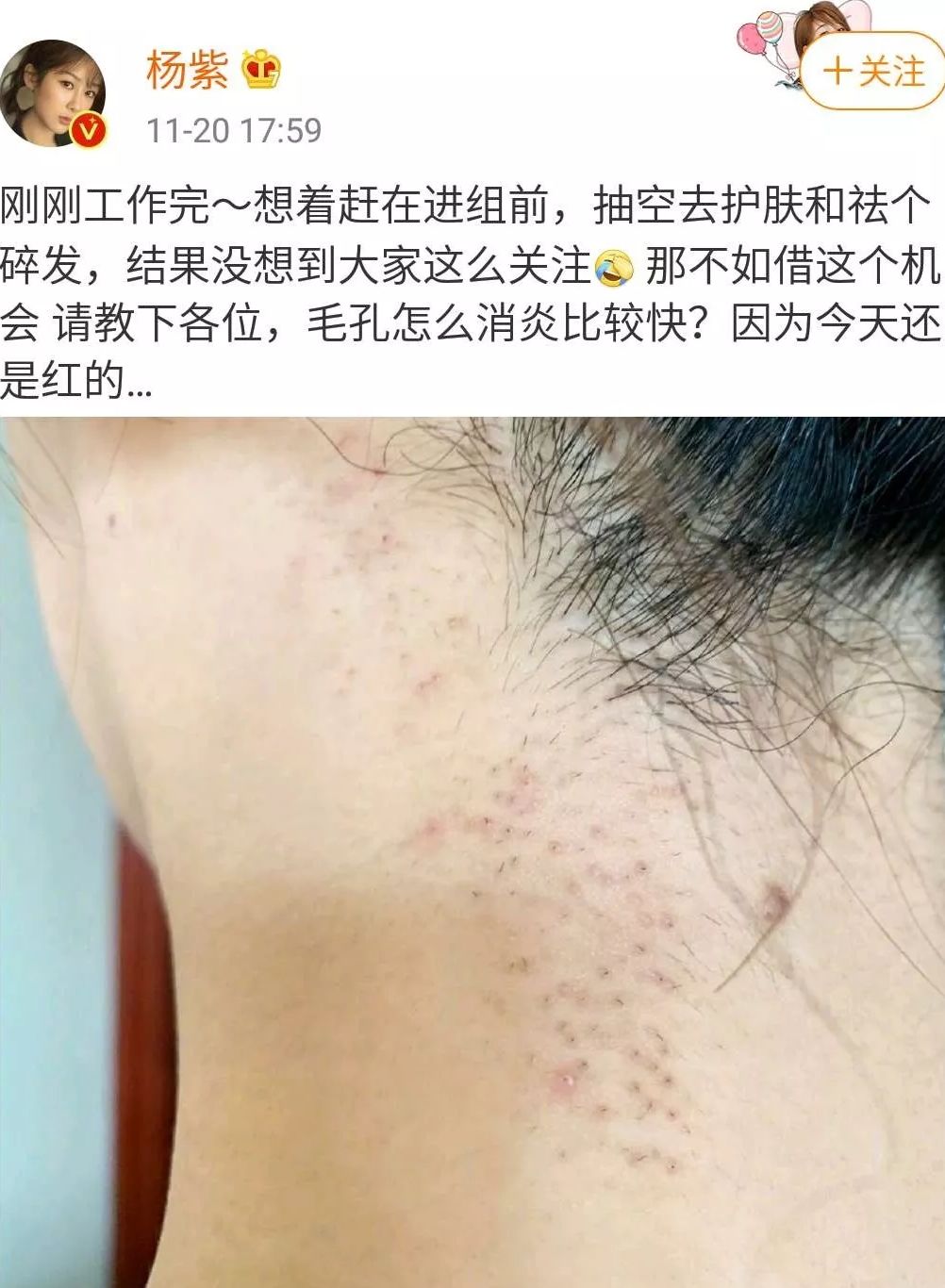 医美整形有哪些项目,医美不等于变美