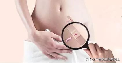 做宫腔镜手术之后二十天会怀孕吗,门诊宫腔镜之后多久可以安排怀孕