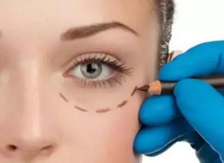 去眼袋15年后有细纹怎么办,祛眼袋之后会不会看着很平