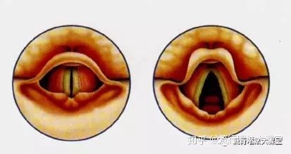 唱歌技巧不会怎么办,唱歌技巧唱不到高音