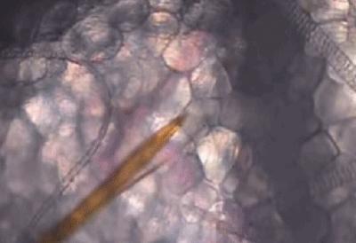 咬人的虫子跟蚂蚁相似,相似于毛毛虫又会咬人的虫子