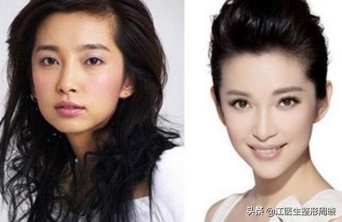 瘦脸针敢不敢打,瘦脸针不要随便打