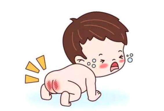 宝宝臀部肌肤怎么护理,宝宝臀部预防与护理技巧